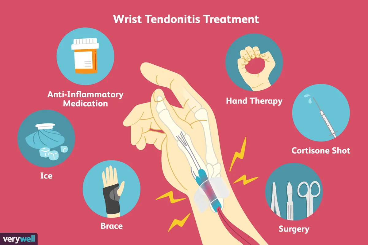 2548611 Article Wrist Tendonitis 5a71f4a0d8fdd5003613b12c