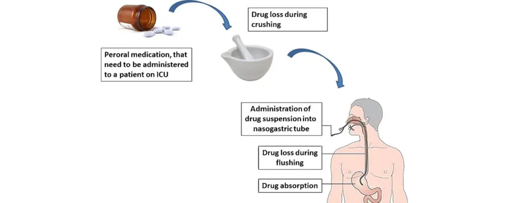 ADMINISTERING MEDICATION THROUGH NASO GASTRIC TUBE