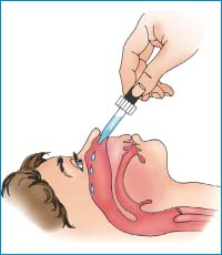 ADMINISTERING NASAL DROPS 1