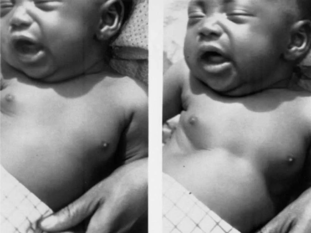 ASSESS AND CLASSIFY A SICK YOUNG INFANT 0 2 MONTHS