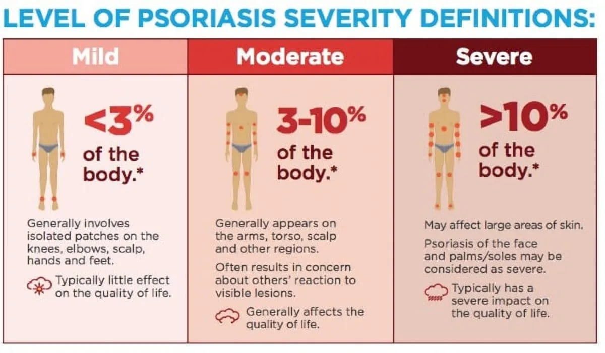 Assessment Of Severity 1