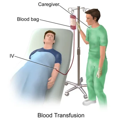 BLOOD TRANSFUSION