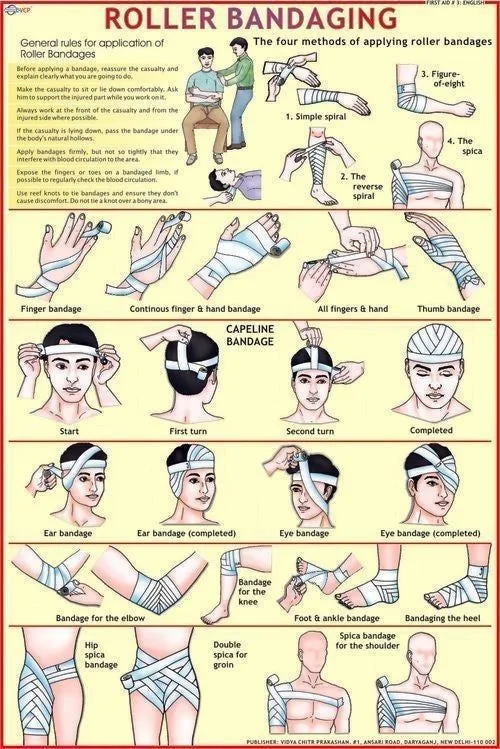 Bandaging Patterns