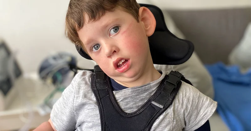 CEREBRAL PALSY