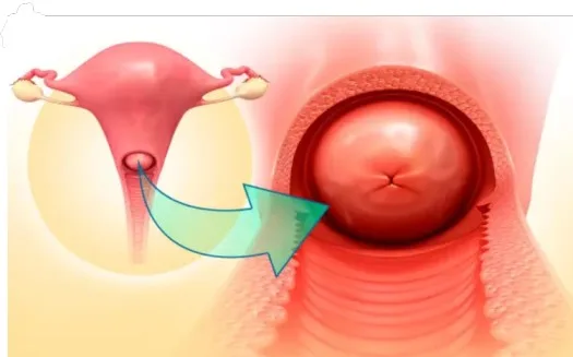 CERVIX