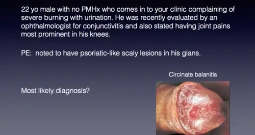 CHANCROID BALANITIS And SYPHILIS 1 E1707284473363