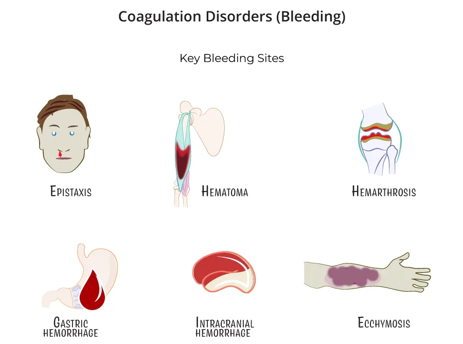 COAGULATION DISORDERS E1753081200825