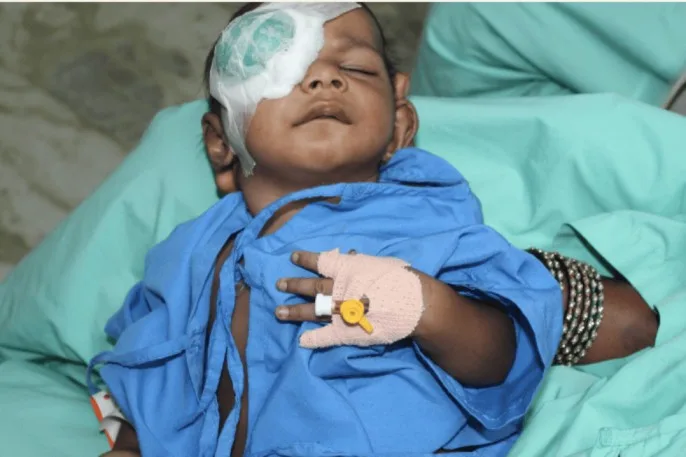 Care Of A Child Under Going Eye Surgery 1