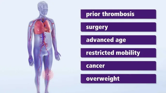 Causes And Risk Factors Of A Thrombus