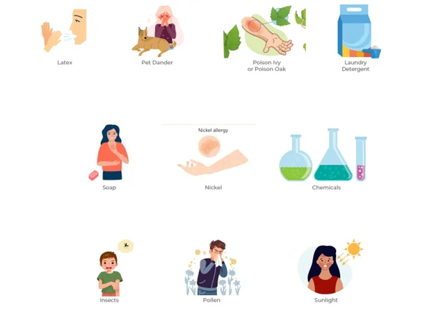 Causes And Triggers Of Skin Allergies E1708076670848