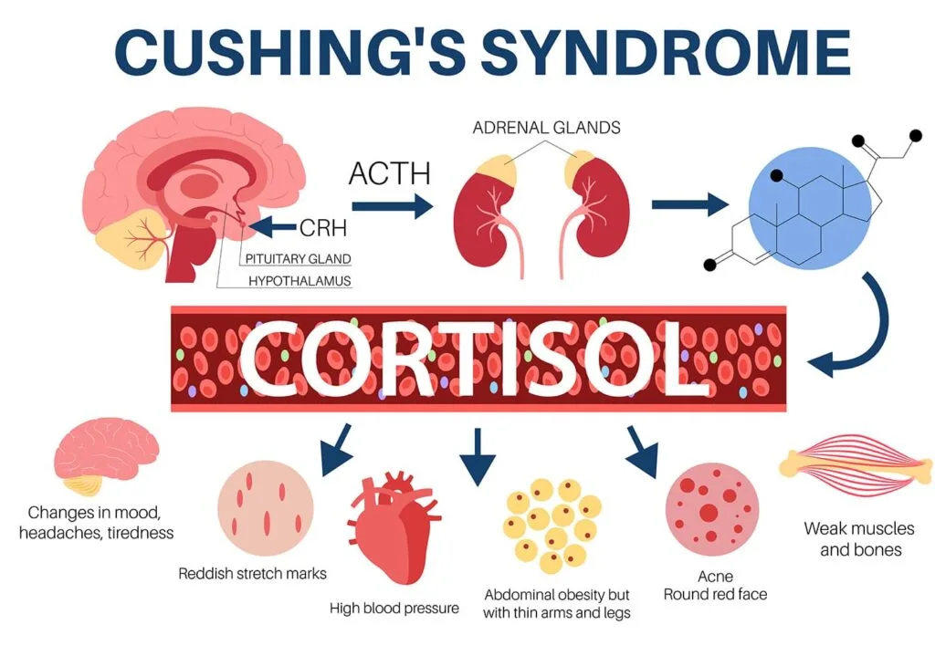 Causes Of Cushings Syndrome 1