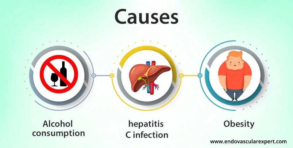 Causes Of Liver Cirrhosis