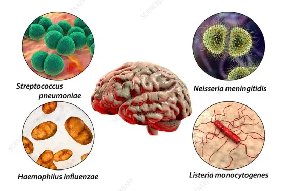 Causes Of Meningitis And Their Mode Of Transmission. 1