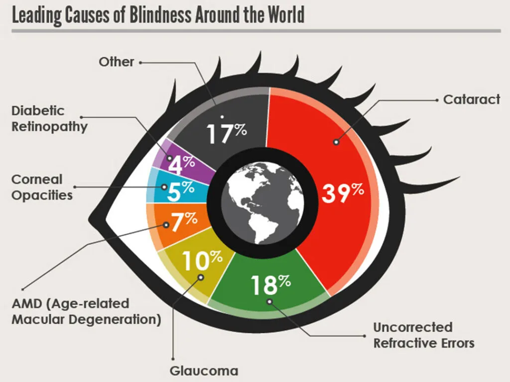 Causes Of Visual Impairement