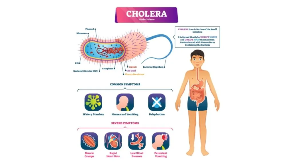 Cholera