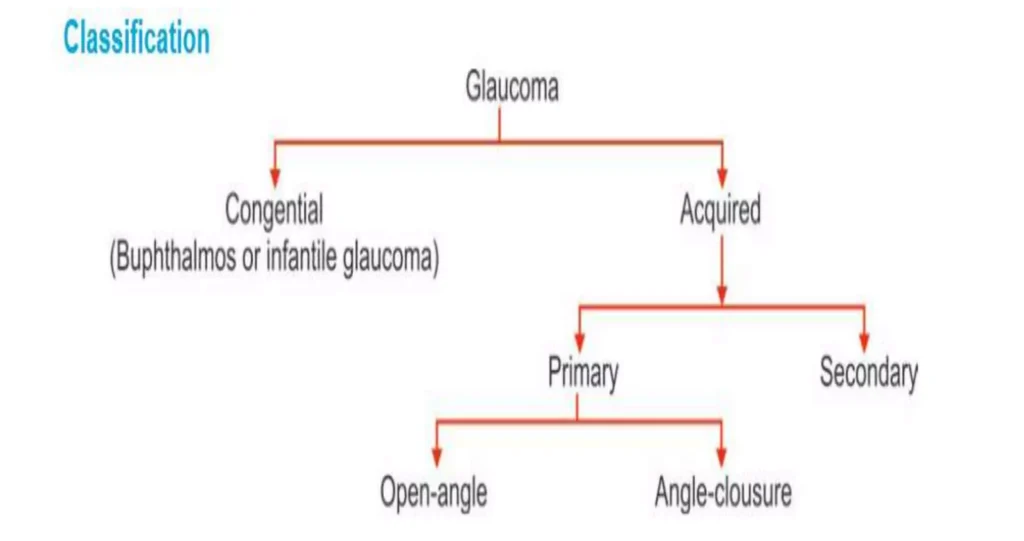 Classification Of Glaucoma E1708185863103