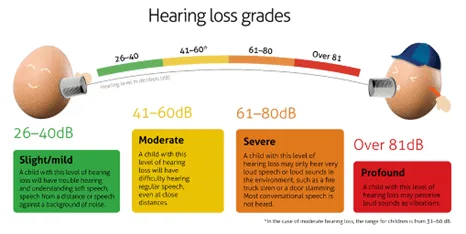 Classification Or Grading Of Hearing Loss