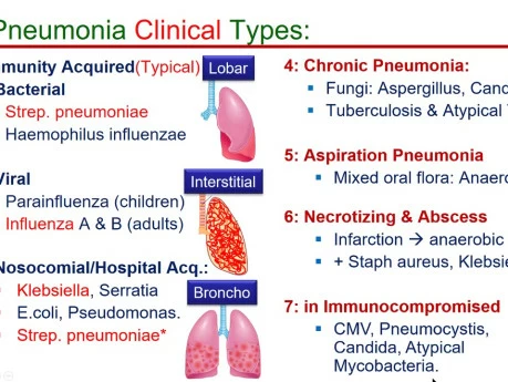 Classifications Of Pneumonia