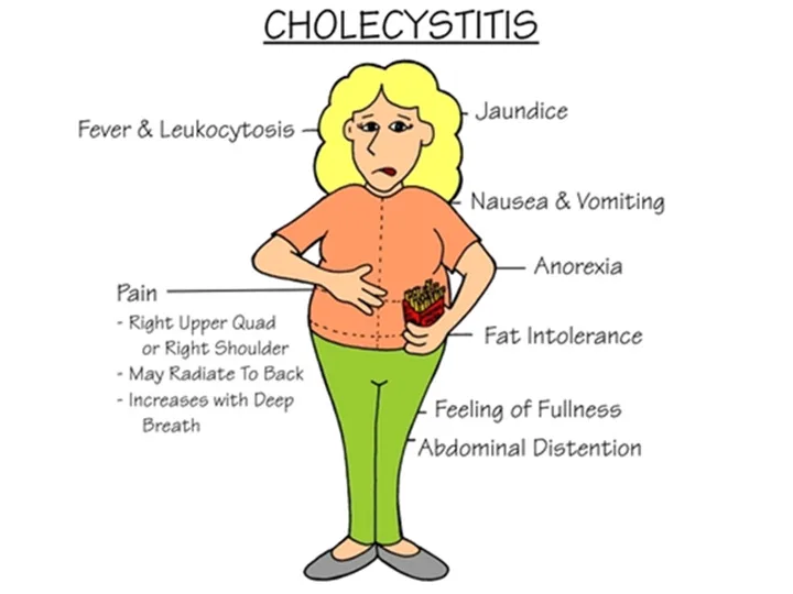 Clinical Features Of Cholecystitis
