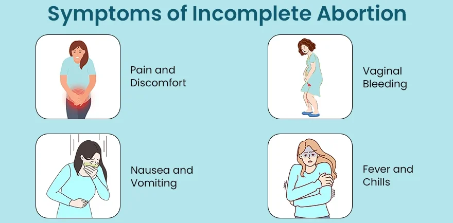 Clinical Features Of Incomplete Abortion E1705417046495