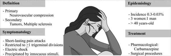 Clinical Features Of Trigeminal Neuralgia