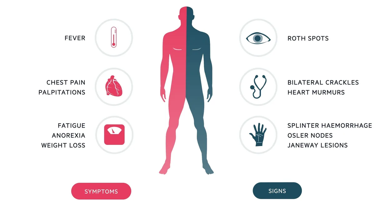 Clinical Manifestations Signs And Symptoms Of Endocarditis 1