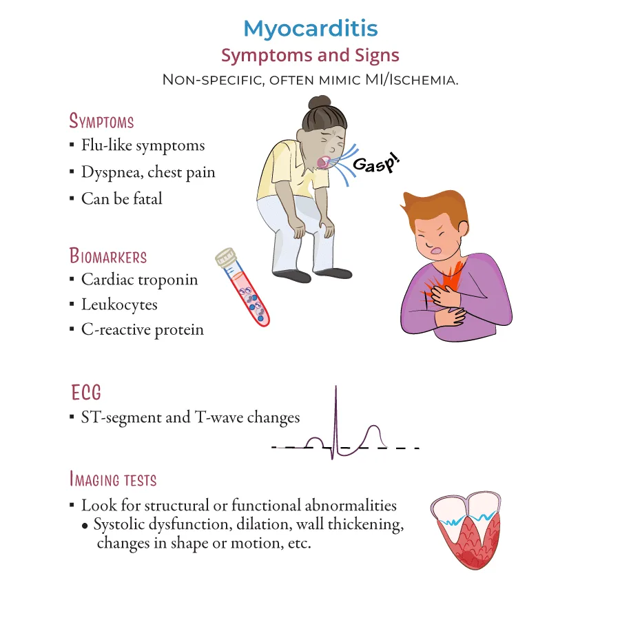 Clinical Manifestations Signs And Symptoms Of Myocarditis 1