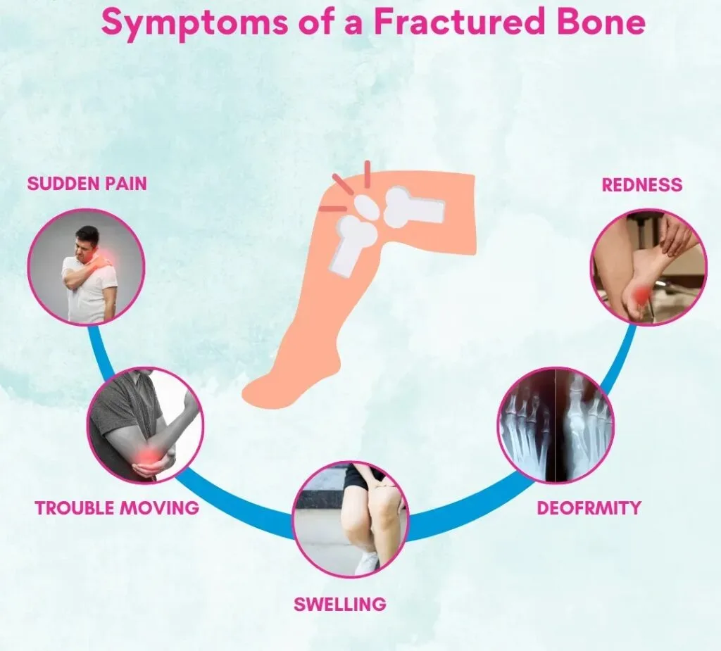 Clinical Manifestations Of Fractures