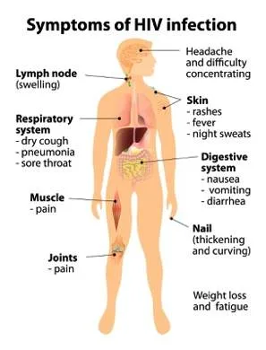 Clinical Manifestations Of HIV AIDS