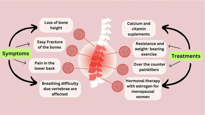 Clinical Manifestations Of Osteoporosis Management