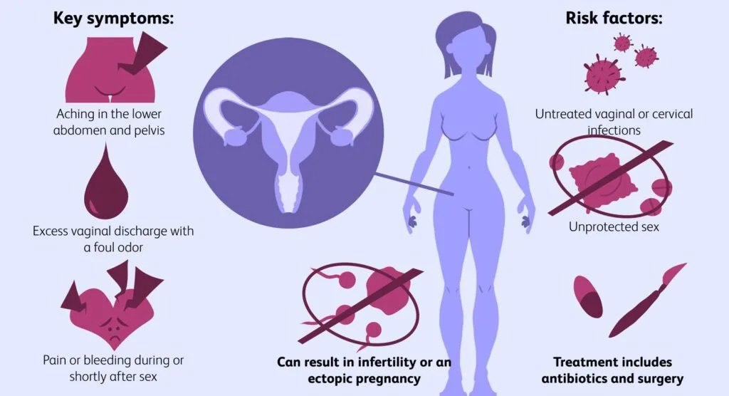 Clinical Manifestations Of Pelvic Inflammatory Diseases PID E1705562135219