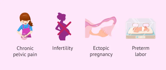 Complications Of Pelvic Inflammatory Disease PID