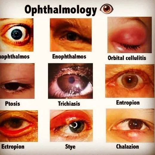 Congenital Eye Abnormalities