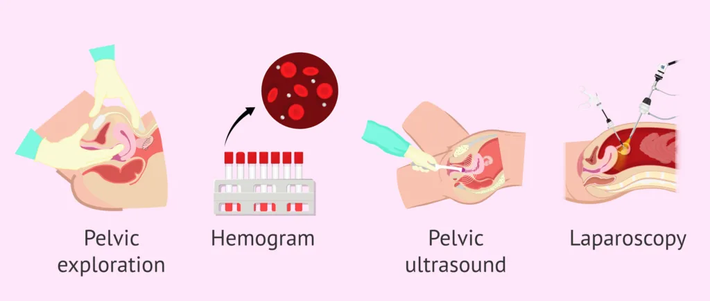 Diagnosis And Investigations For Pelvic Inflammatory Diseases PID