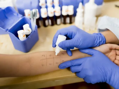Diagnosis And Investigations Of Allergies Plant 1