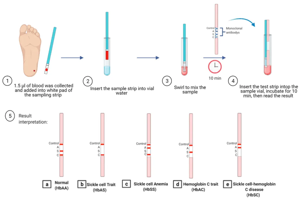Diagnosis And Investigations Sickle 2 1