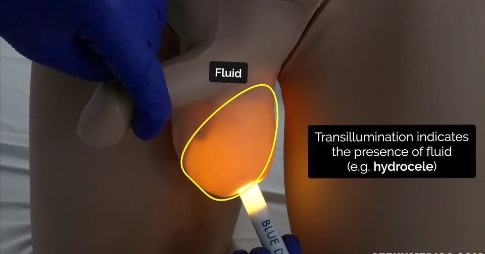 Diagnosis And Investigations Transillumination E1703607401821