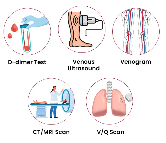 Diagnosis Of A Thrombus