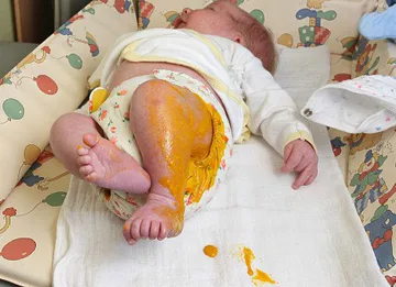 Diarrhoea