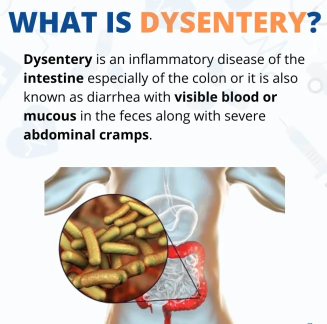 Dysentery 1