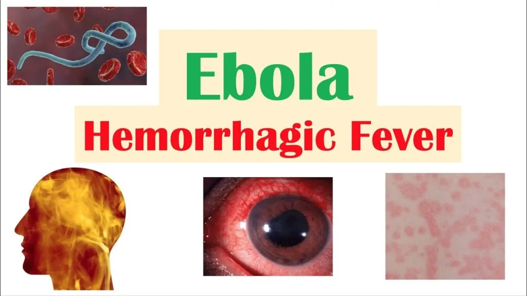 EBOLA HAEMORRHAGIC FEVERS