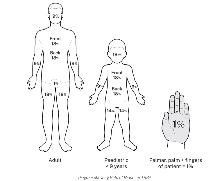 EXTENT OF A BURNT AREA
