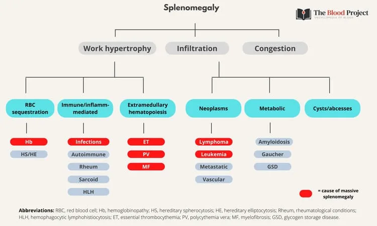 Etiologies Of Splenomegaly