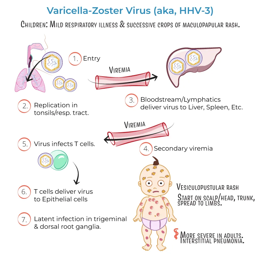 Etiology And Pathophysiology Of Herpes Zoster 1
