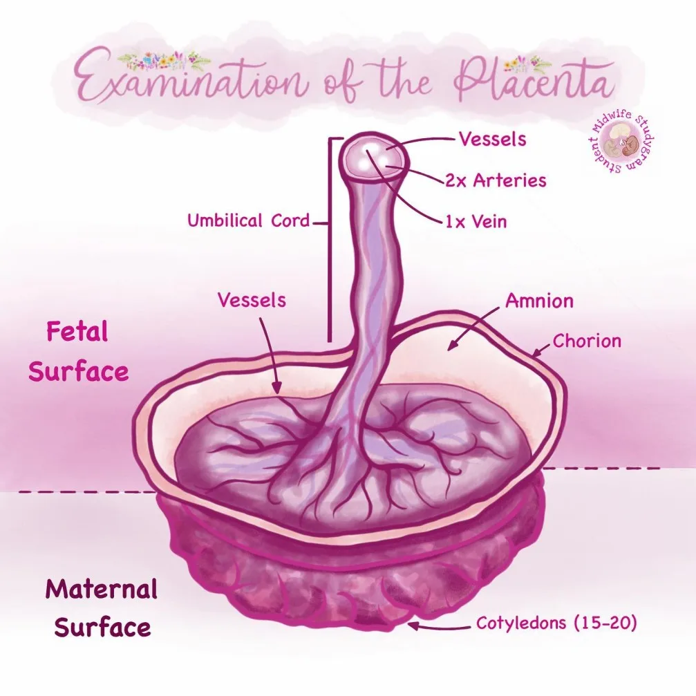 Examination Of Placenta 1