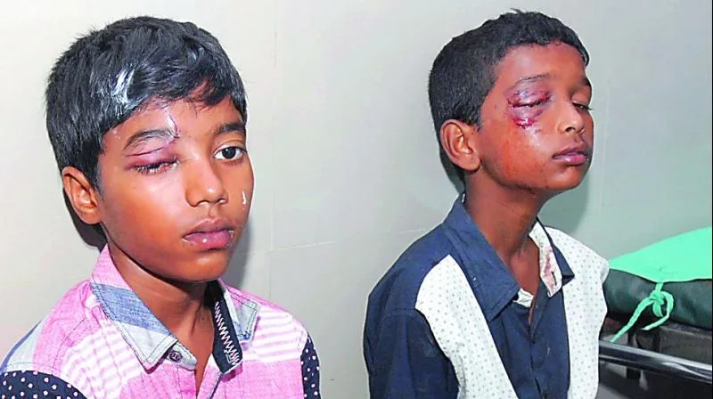Eye Injuries In Children Paediatrics