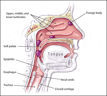 FOREIGN BODIES IN THE EAR NOSE AND THROAT