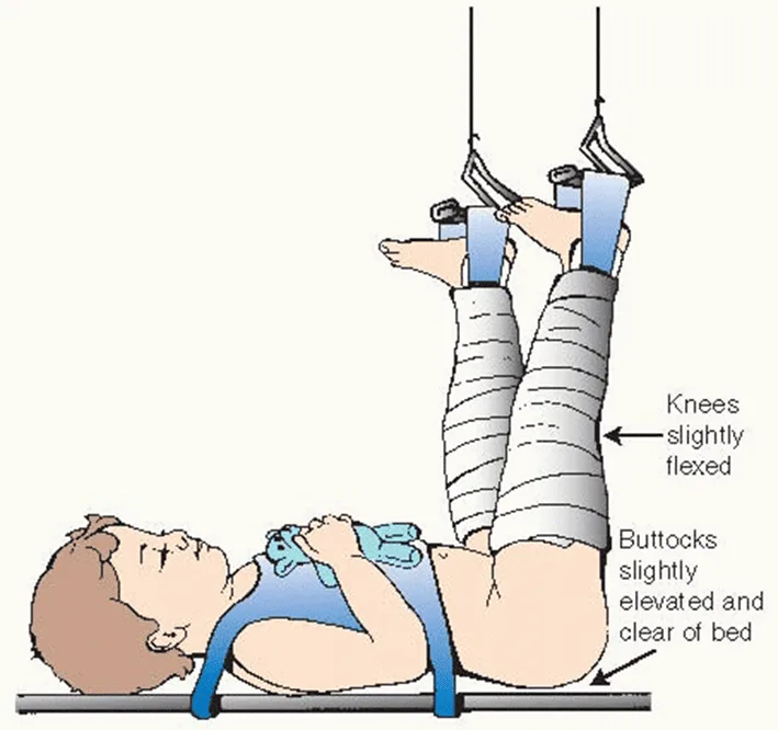 Gallows TractionBryants Traction 1