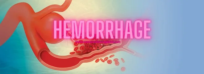 HEMORRHAGE
