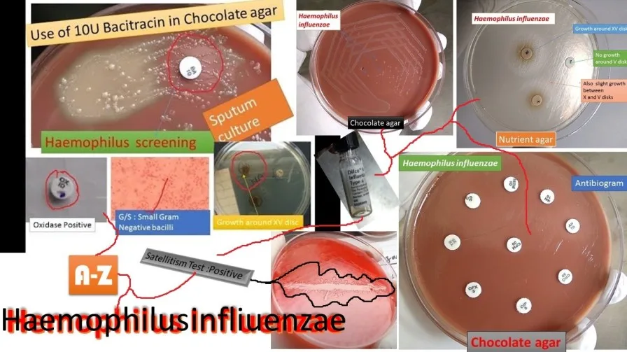 Haemophilus Influenzae 1 1